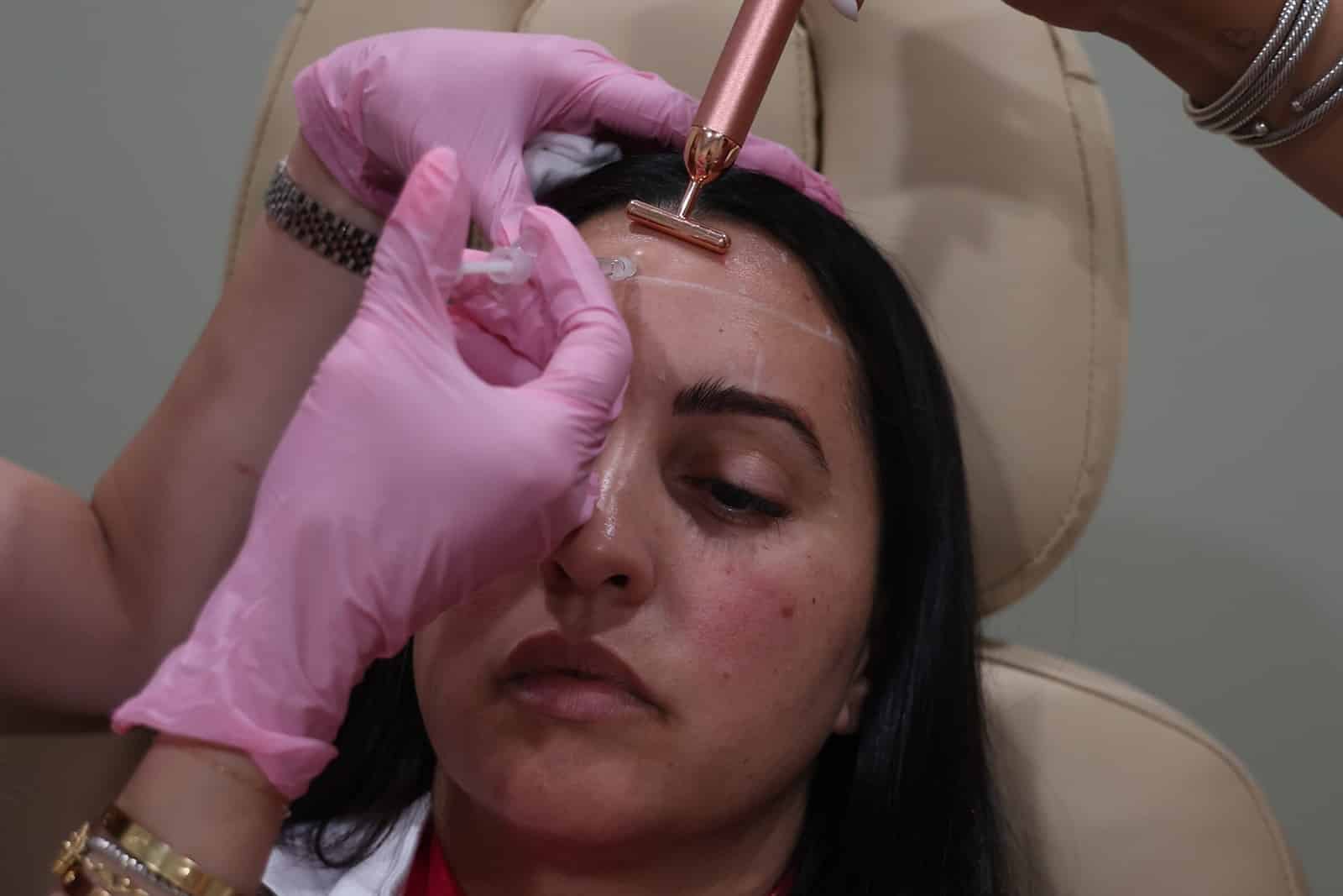 Botox treatment at White Coat Glam Miami